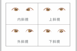 山下智久 整形 斜視