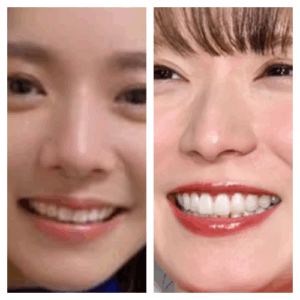 比較口元milet×松岡茉優
